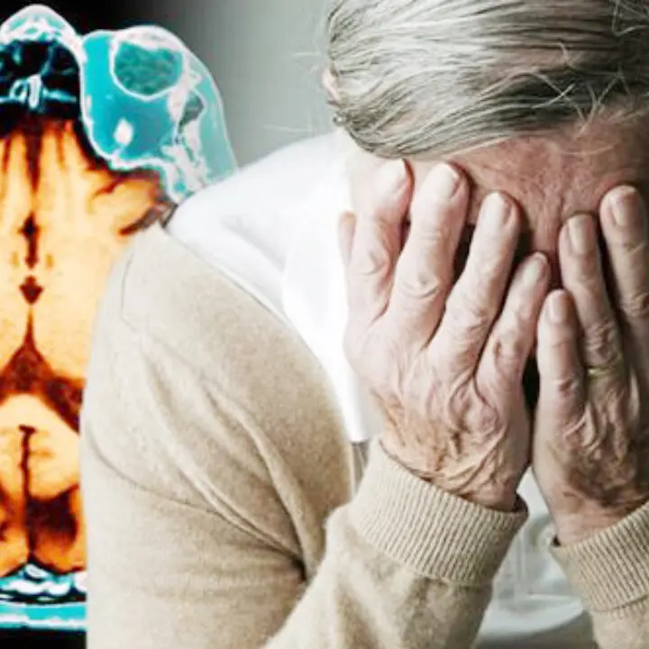 Una molecola smart contro l’Alzheimer,\u00A0in laboratorio nasce\u00A0Sulfavant A: nello studio anche l’Umg di Catanzaro\n