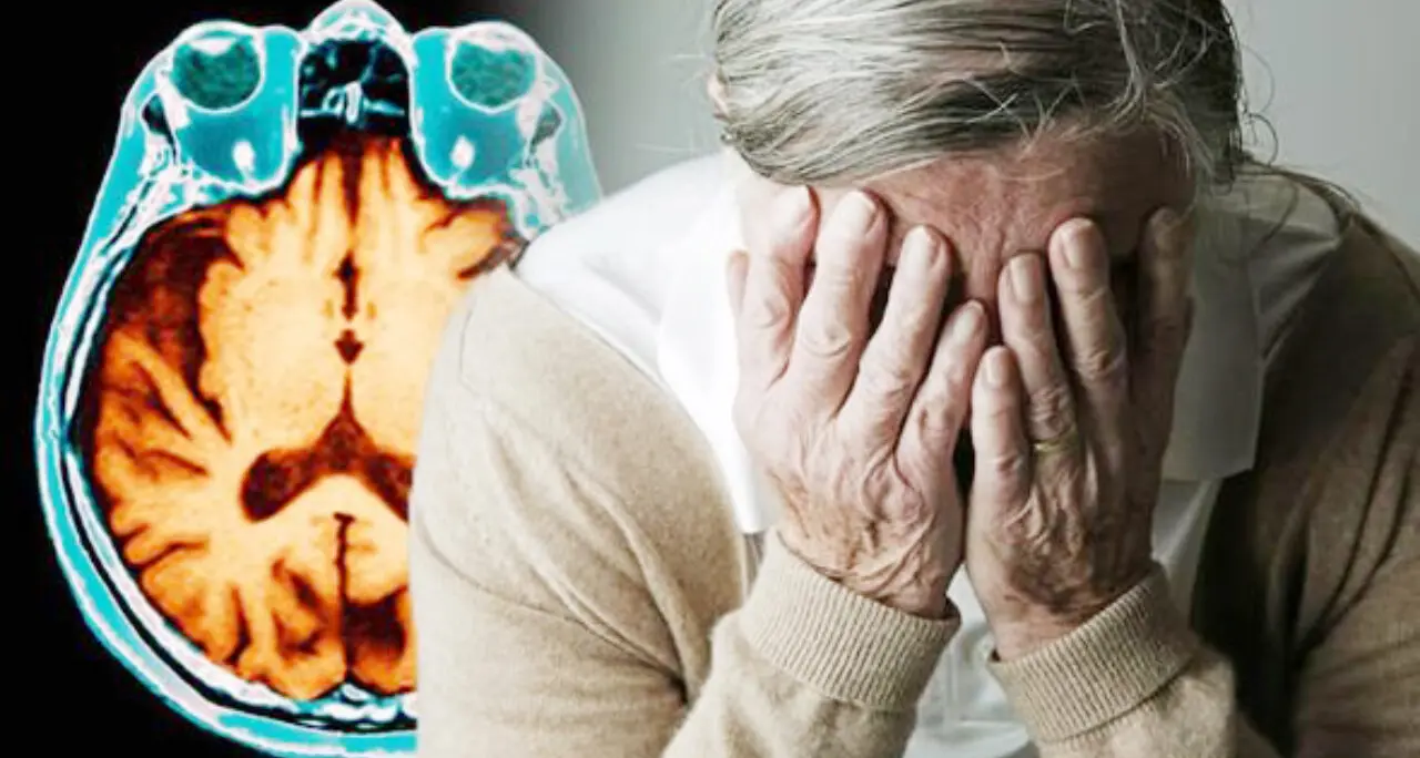 Una molecola smart contro l’Alzheimer,\u00A0in laboratorio nasce\u00A0Sulfavant A: nello studio anche l’Umg di Catanzaro\n