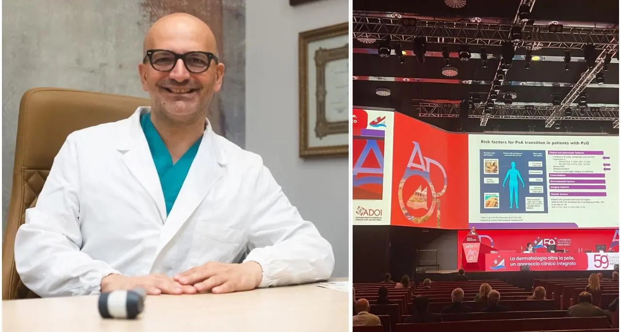 Cosenza ospita il congresso nazionale di dermatologia, Pietro Morrone: «IA ausilio fondamentale per i pazienti oncologici»\n