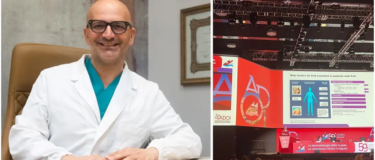 Cosenza ospita il congresso nazionale di dermatologia, Pietro Morrone: «IA ausilio fondamentale per i pazienti oncologici»\n