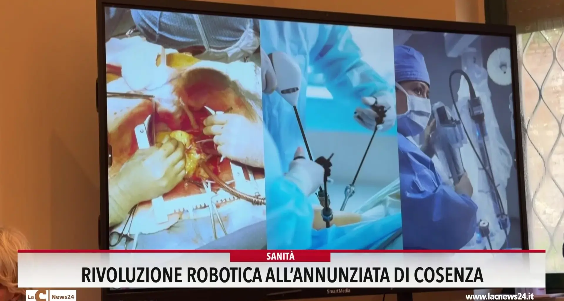 Rivoluzione robotica all'Annunziata di Cosenza