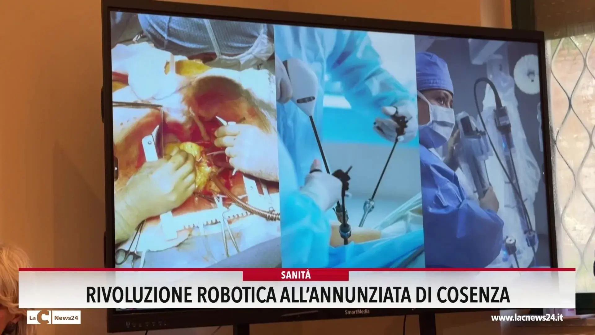 Rivoluzione robotica all'Annunziata di Cosenza