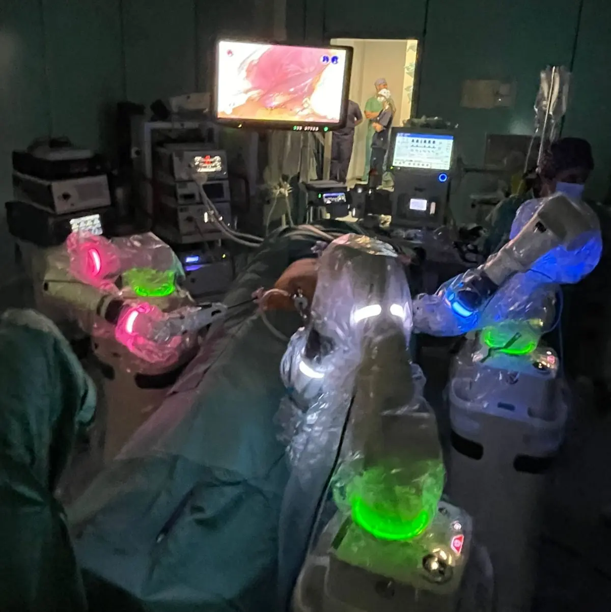 L’Asp\u00A0di Catanzaro avvia la chirurgia di precisione con il sistema robotico “Versius” a Lamezia Terme\n