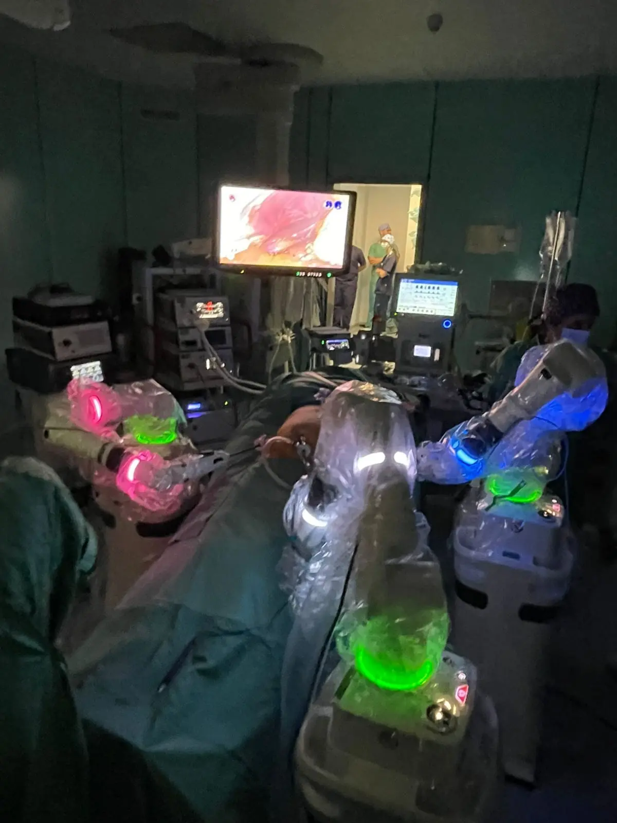 L’Asp\u00A0di Catanzaro avvia la chirurgia di precisione con il sistema robotico “Versius” a Lamezia Terme\n