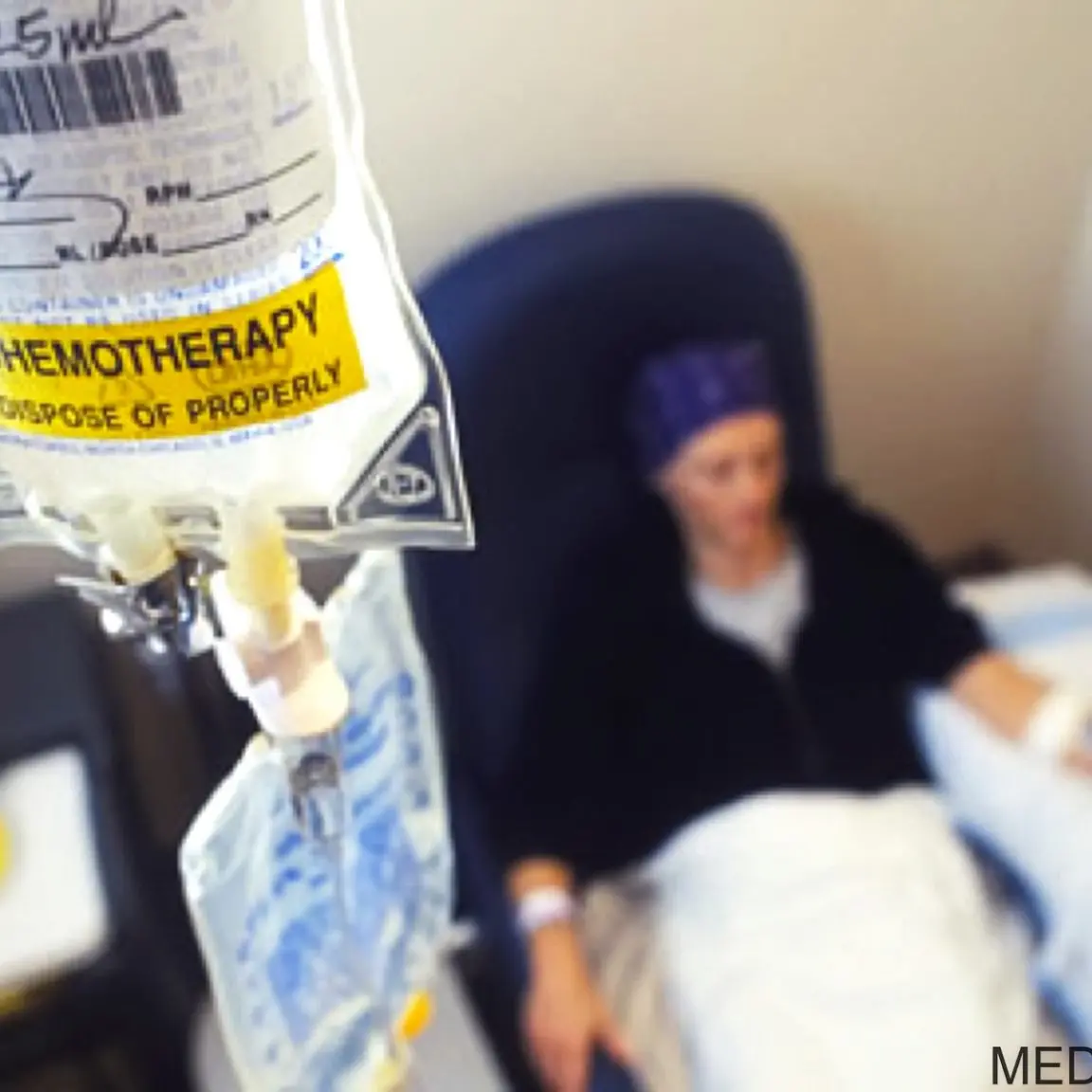 Tumori, un prelievo di sangue in futuro potrà prevedere l'efficacia della chemioterapia\n