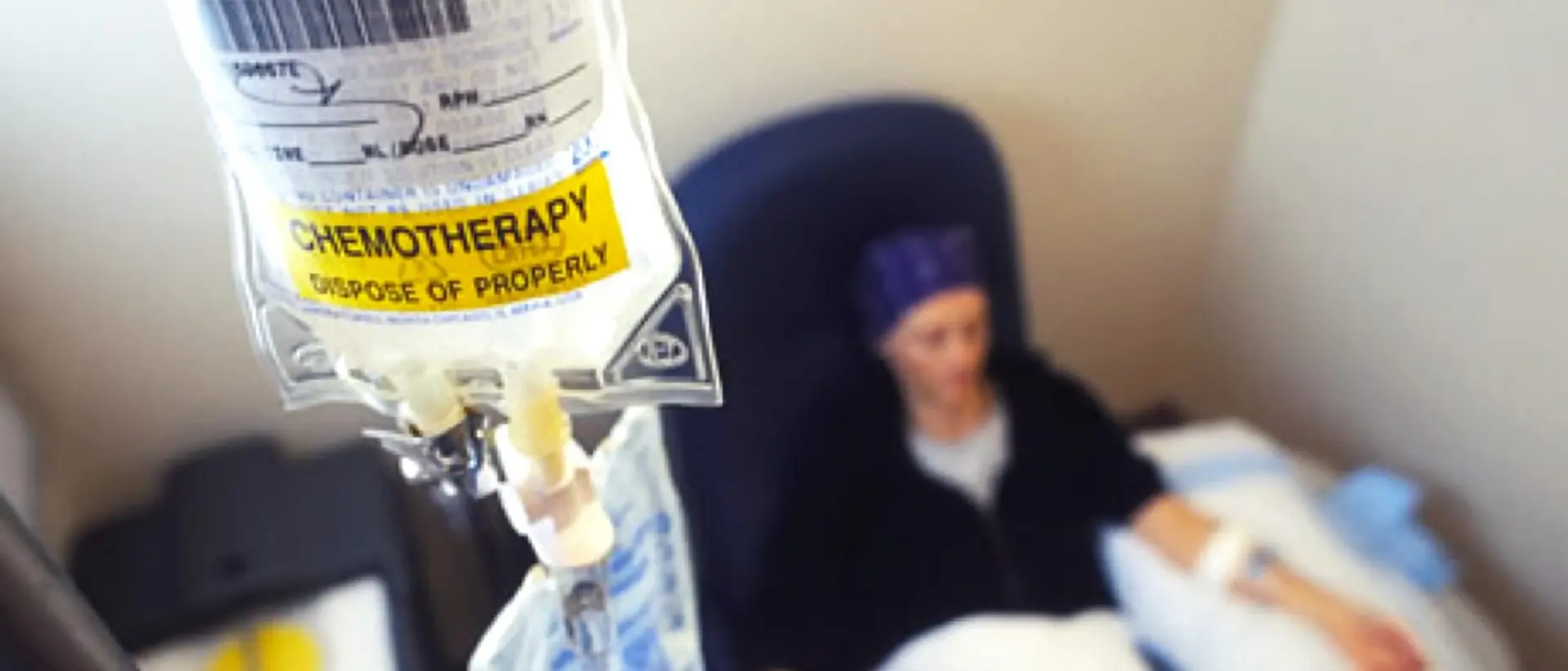 Tumori, un prelievo di sangue in futuro potrà prevedere l'efficacia della chemioterapia\n