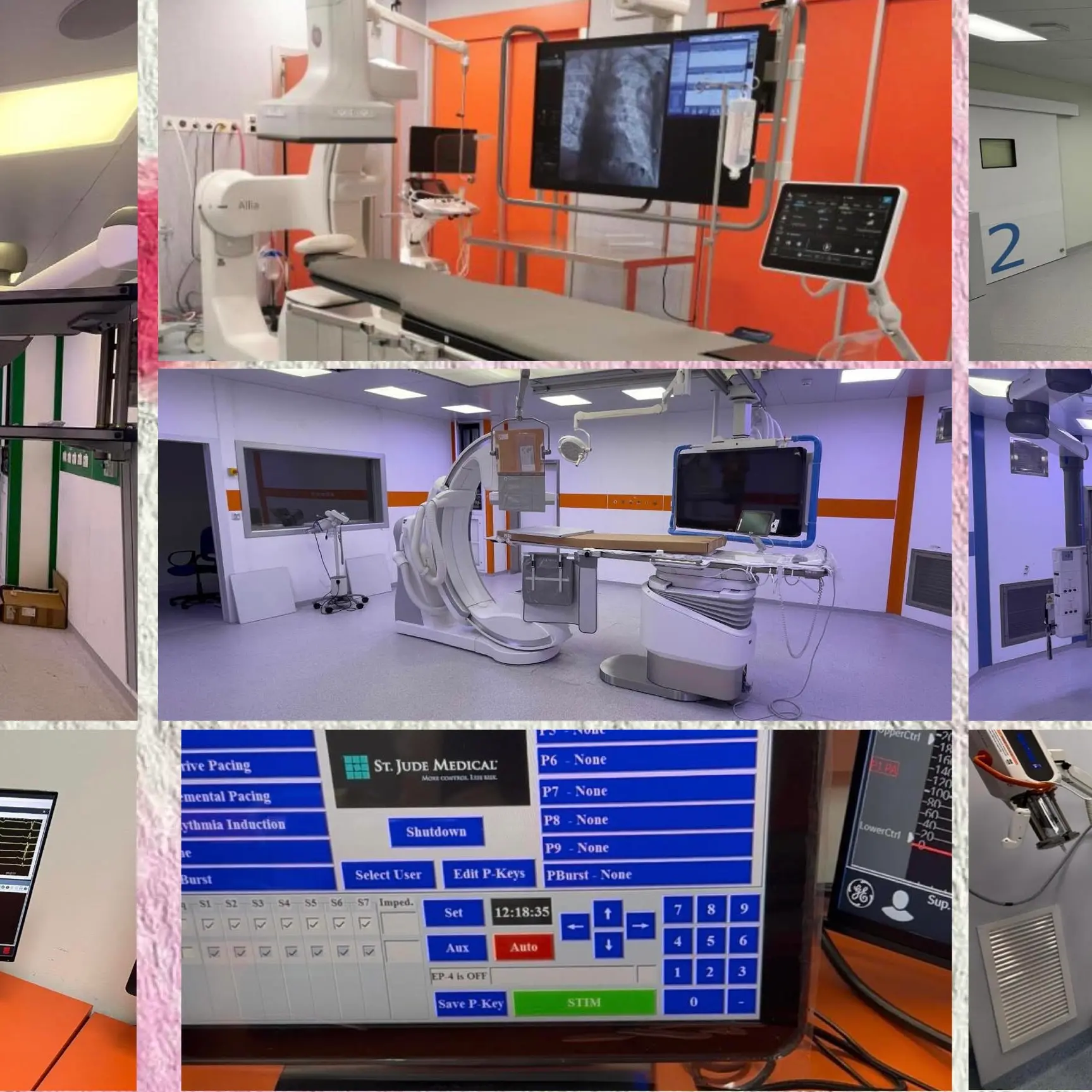 Cardiologia dell’ospedale di Cosenza, De Salazar annuncia: «Avviato un percorso di rinnovamento del reparto»\n