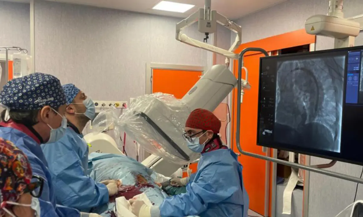 Cosenza, all’Annunziata utilizzata un’endoprotesi ramificata per riparare l'arco aortico\u00A0\n