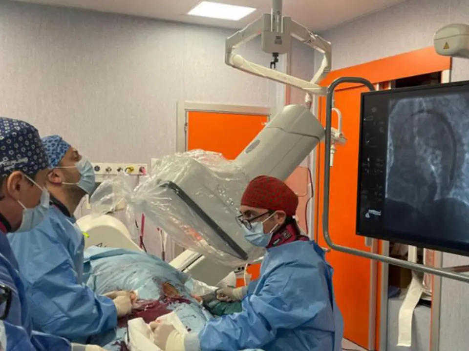 Cosenza, all’Annunziata utilizzata un’endoprotesi ramificata per riparare l'arco aortico