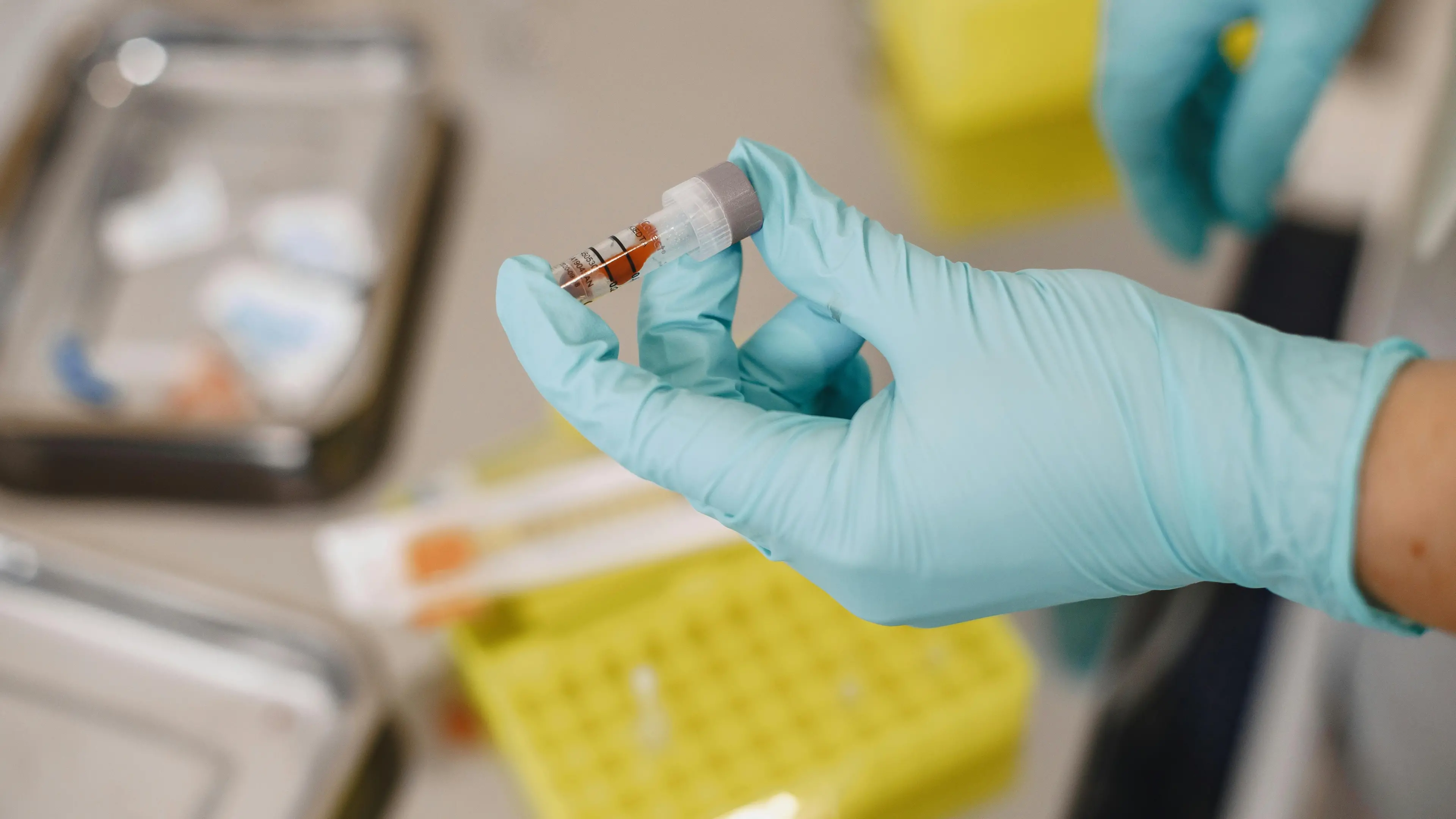 <p>Allarme <span style=\"color:hsl(0, 75%, 60%);\">Epatite A</span>, casi anche in Calabria: sospetto legame con gli eventi meteo estremi delle scorse settimane</p>