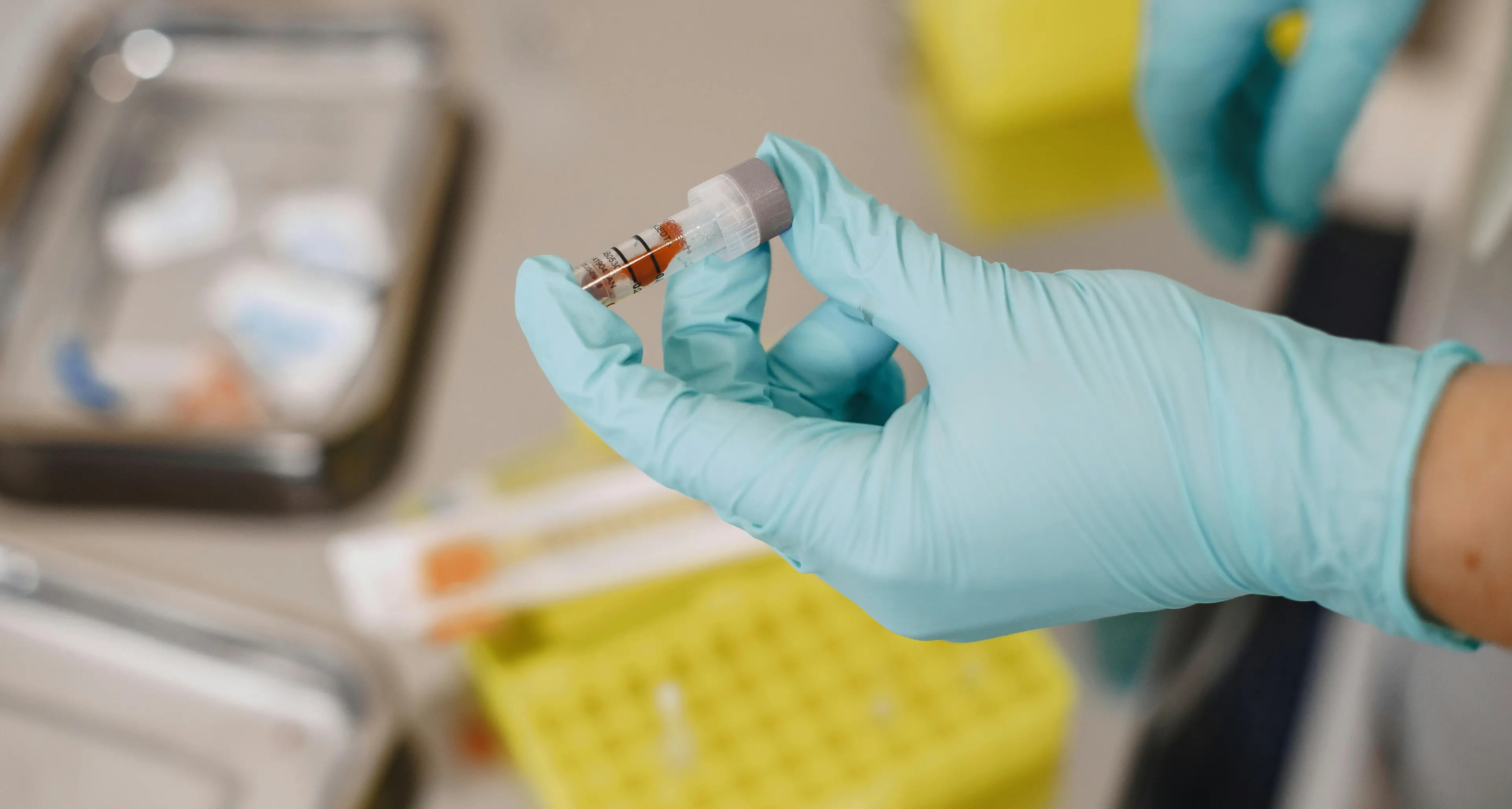 Allarme Epatite A, casi anche in Calabria: sospetto legame con gli eventi meteo estremi delle scorse settimane\n