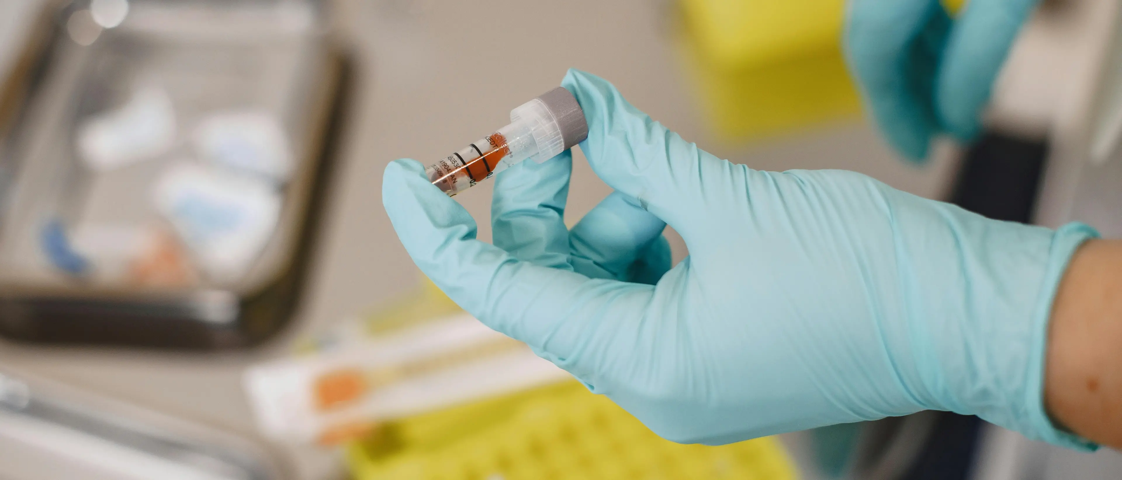 Allarme Epatite A, casi anche in Calabria: sospetto legame con gli eventi meteo estremi delle scorse settimane\n