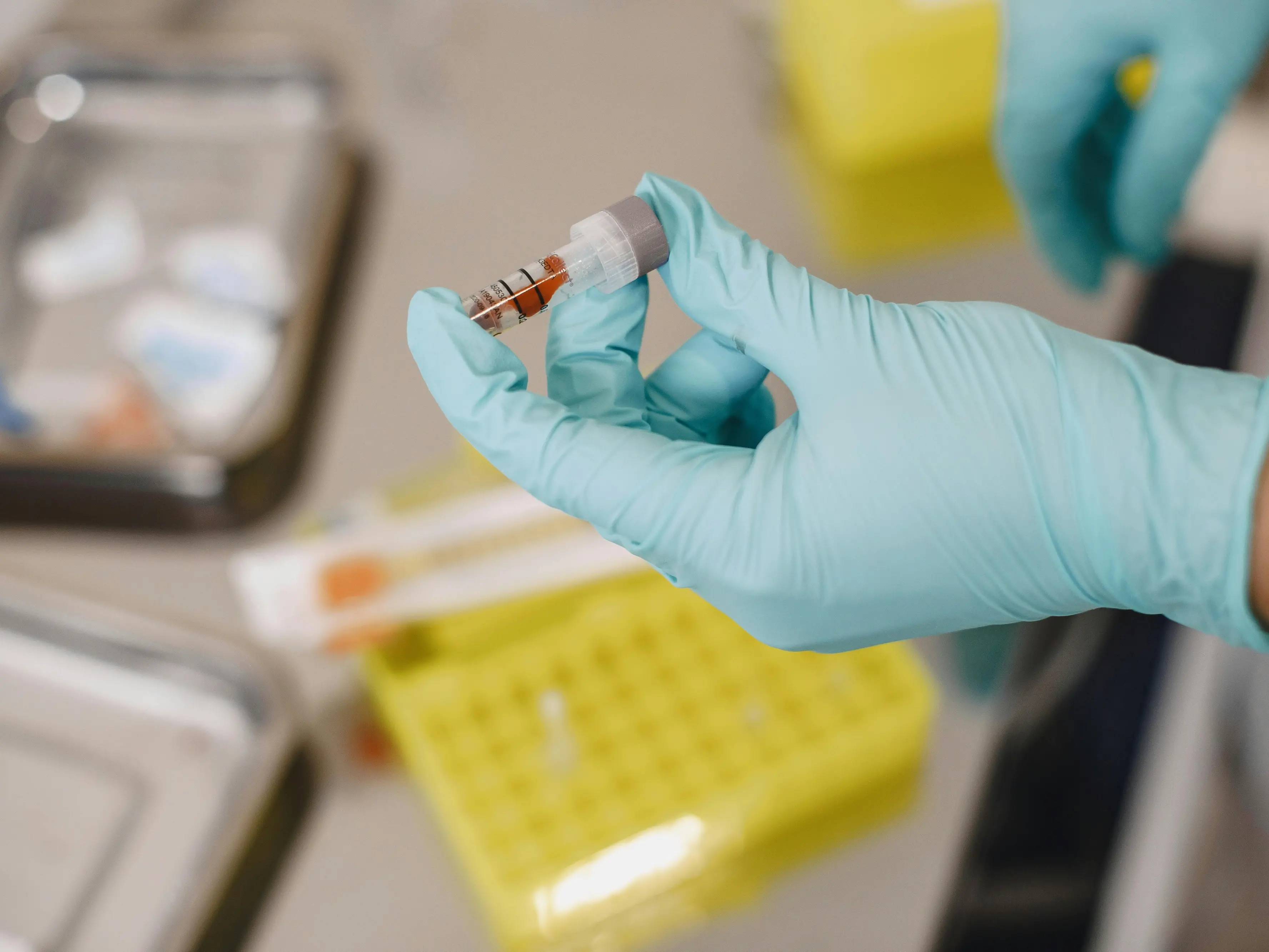 Allarme Epatite A, casi anche in Calabria: sospetto legame con gli eventi meteo estremi delle scorse settimane