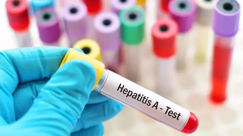 <p>Epatite A, casi anche in Calabria: tra Lamezia e Catanzaro quattro ricoveri</p>