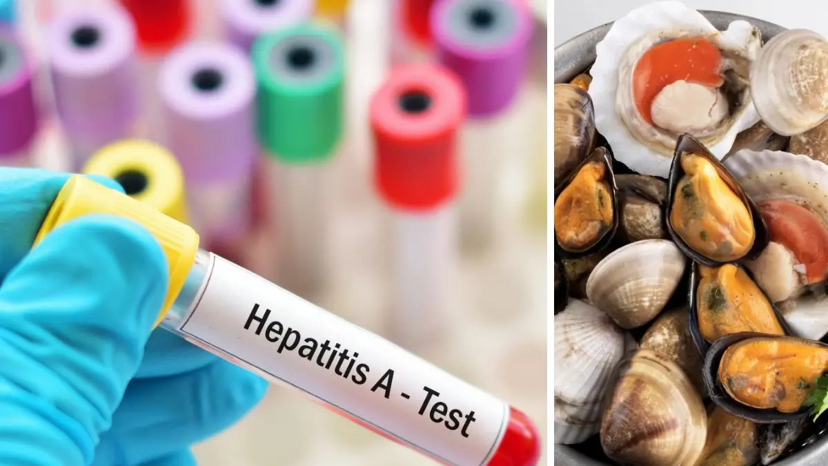 Casi di Epatite A in ospedale a Cosenza