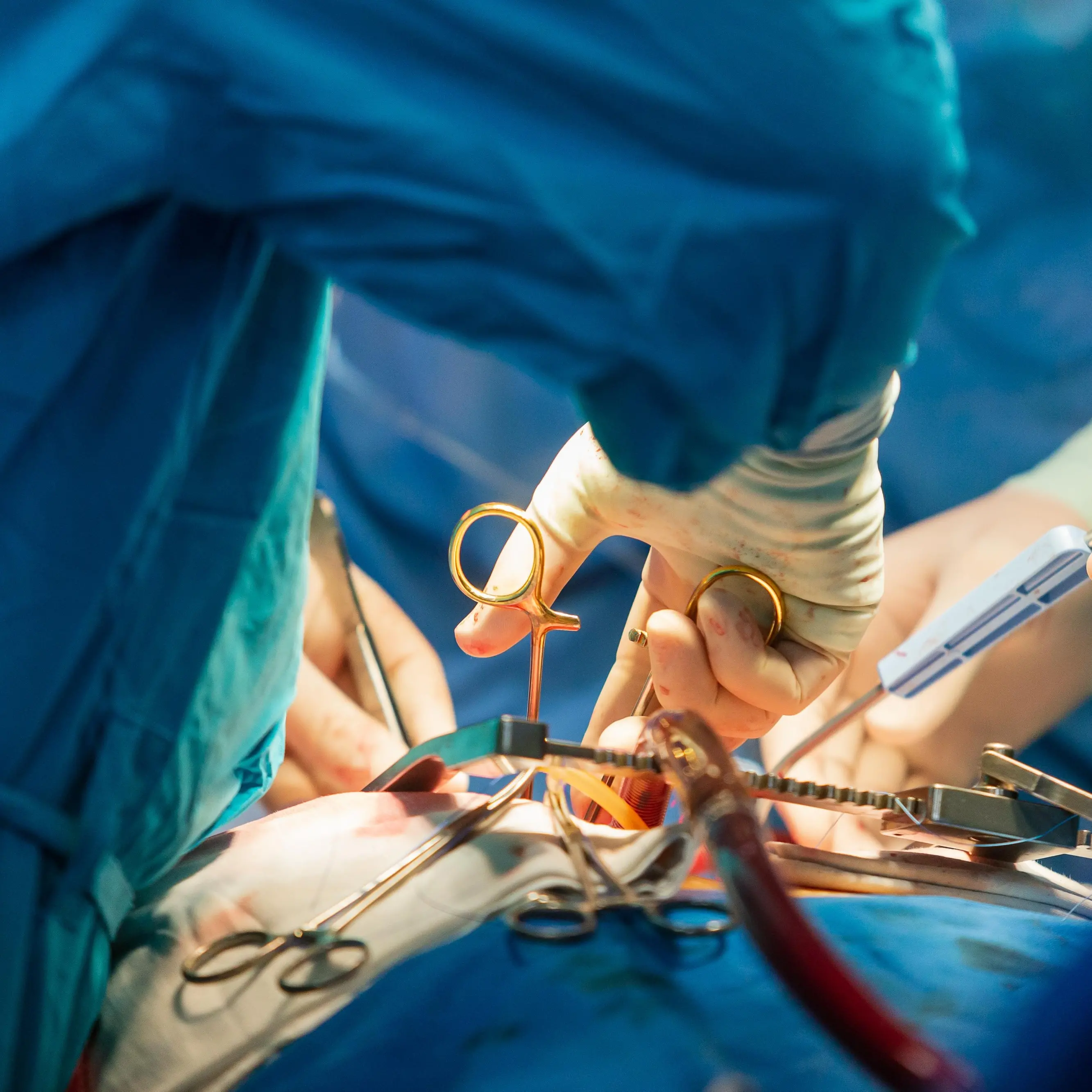 Record di trapianti nel 2025, Schillaci:\u00A0«Fra i\u00A0primi\u00A0in Europa ma ancora troppi giovani negano il consenso alla donazione»\n