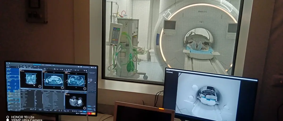 Al Gom\u00A0arriva la nuova risonanza magnetica 1.5 Tesla: più esami, diagnosi più precise e liste d’attesa da abbattere. Frittelli: «La Calabria dimostra di essere avanti»\n
