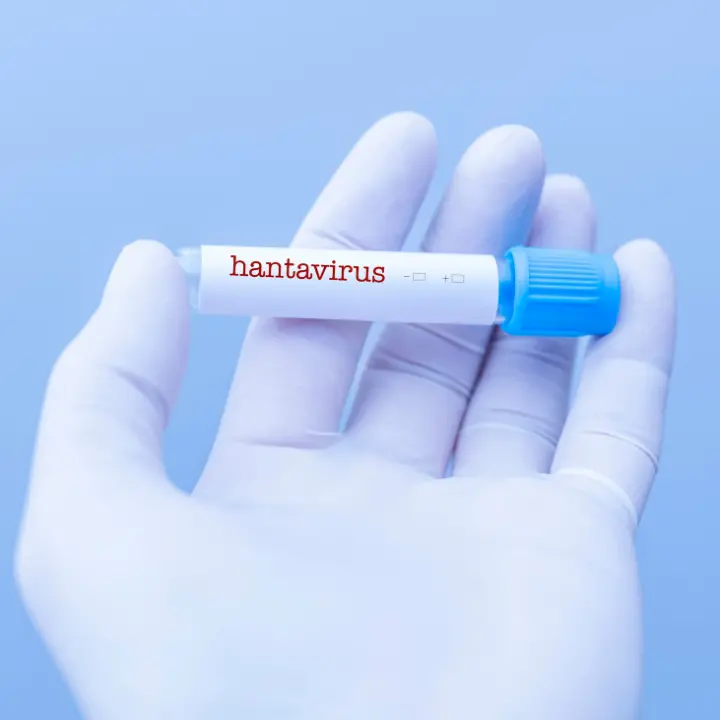 Hantavirus, dalle mascherine ai centri di contenimento: ecco come vanno gestiti i casi sospetti\n
