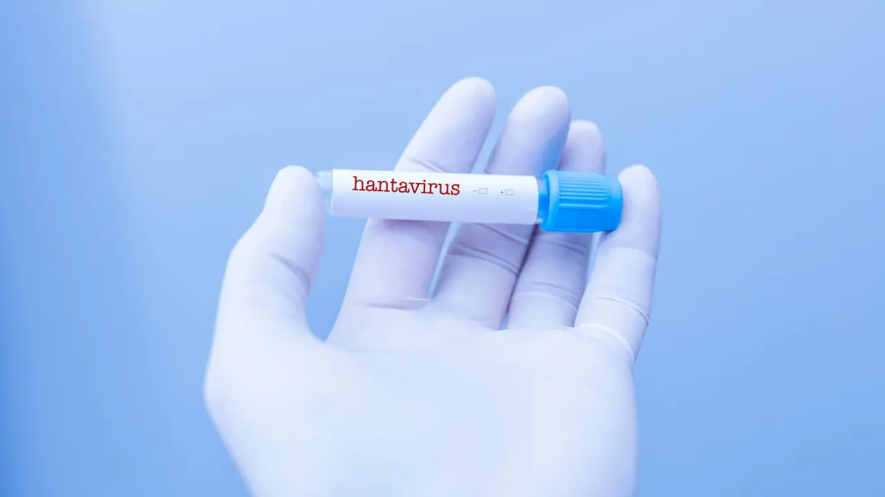 Hantavirus, dalle mascherine ai centri di contenimento: ecco come vanno gestiti i casi sospetti\n