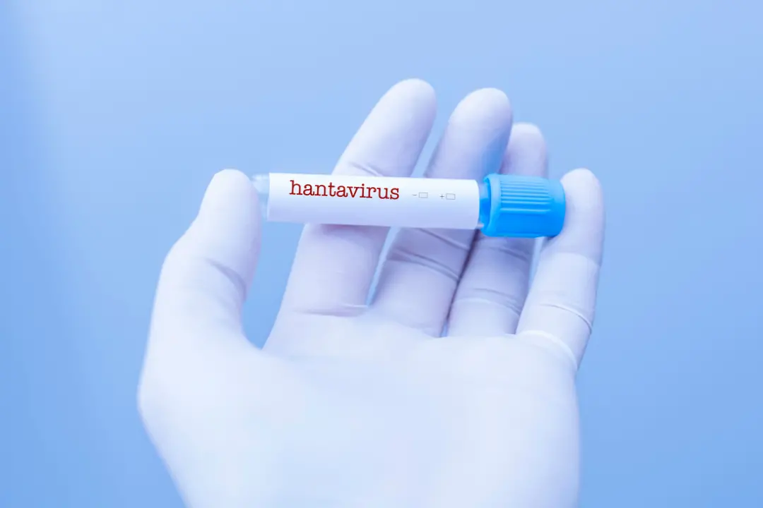 Hantavirus, dalle mascherine ai centri di contenimento: ecco come vanno gestiti i casi sospetti\n