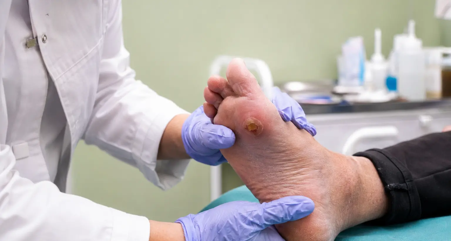 Piede diabetico, la Calabria ospita il primo congresso internazionale in Italia\n