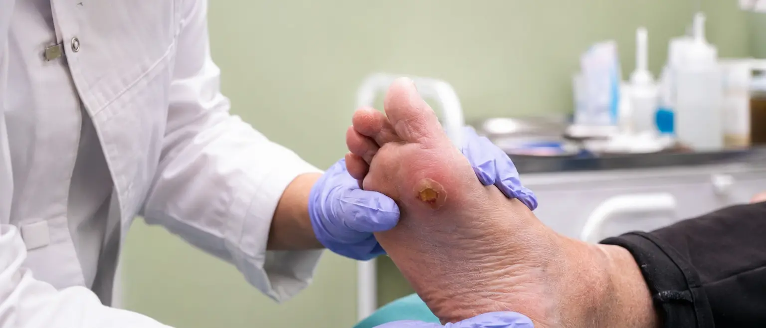 Piede diabetico, la Calabria ospita il primo congresso internazionale in Italia\n