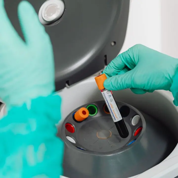 Ebola, l’Organizzazione mondiale della sanità dichiara l’emergenza internazionale a causa di un raro ceppo\n