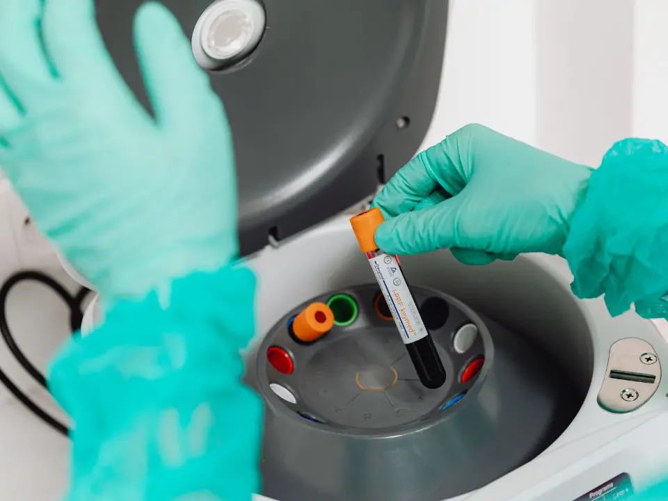 Ebola, l’Organizzazione mondiale della sanità dichiara l’emergenza internazionale a causa di un raro ceppo
