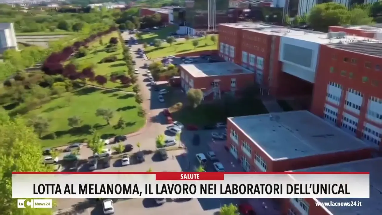 Lotta al melanoma, il lavoro nei laboratori dell'Unical