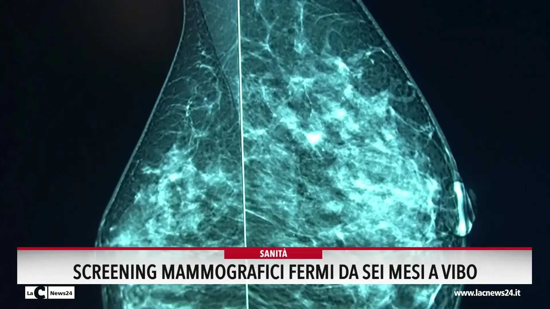 Screening mammografici fermi da sei mesi a Vibo