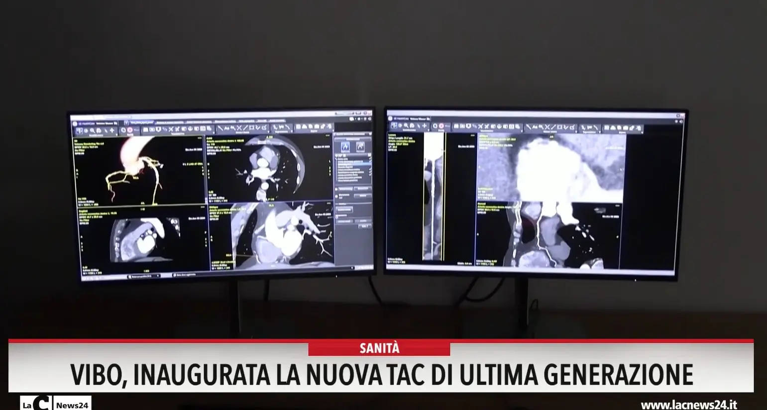 Vibo, inaugurata la nuova tac di ultima generazione