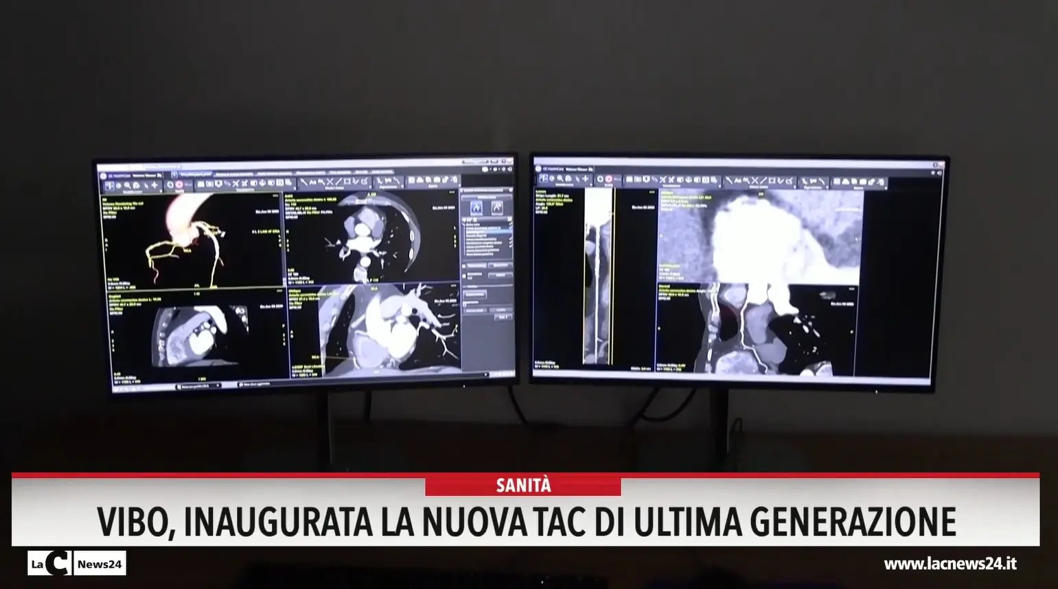 Vibo, inaugurata la nuova tac di ultima generazione