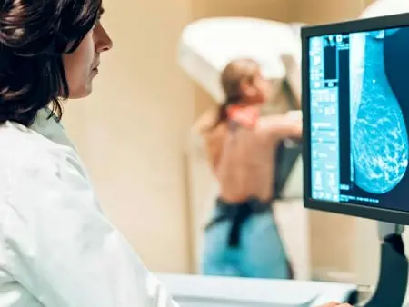 Screening mammografici nel Vibonese, l’Asp rassicura dopo le polemiche: «Prenotazioni attive in tre ospedali della provincia, ecco gli orari»