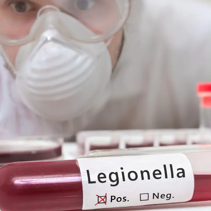 <p>Allarme legionella a Reggio Calabria, albergo chiuso con ordinanza urgente del sindaco</p>