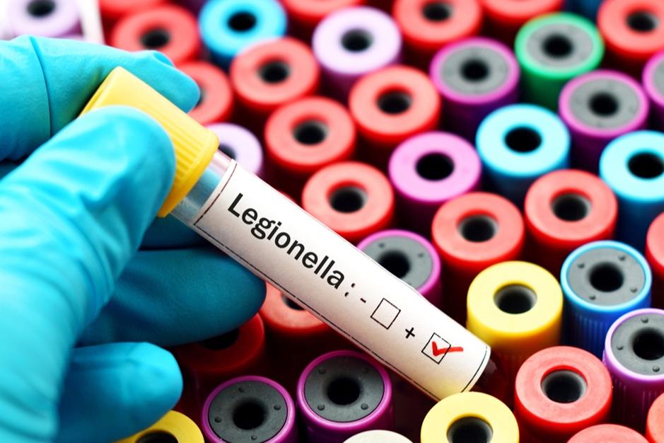 Hotel chiuso per legionella, esperto spiega il rischio dell'acqua nebulizzata e la mancanza di contagio tra persone
