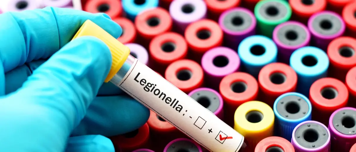 Legionella in un hotel del centro di Reggio, l'esperto: «Il contagio non avviene da persona a persona, il rischio è nell'acqua nebulizzata»\n