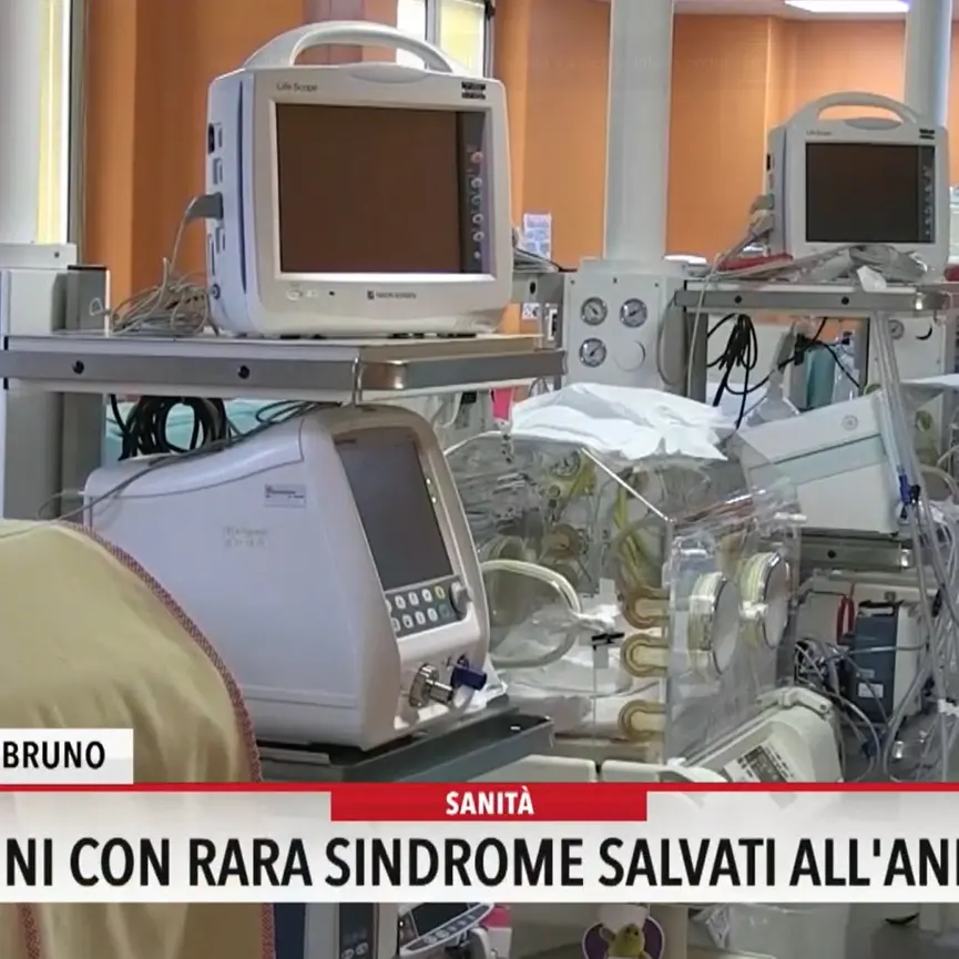 Gemellini con rara sindrome salvati all'Annunziata