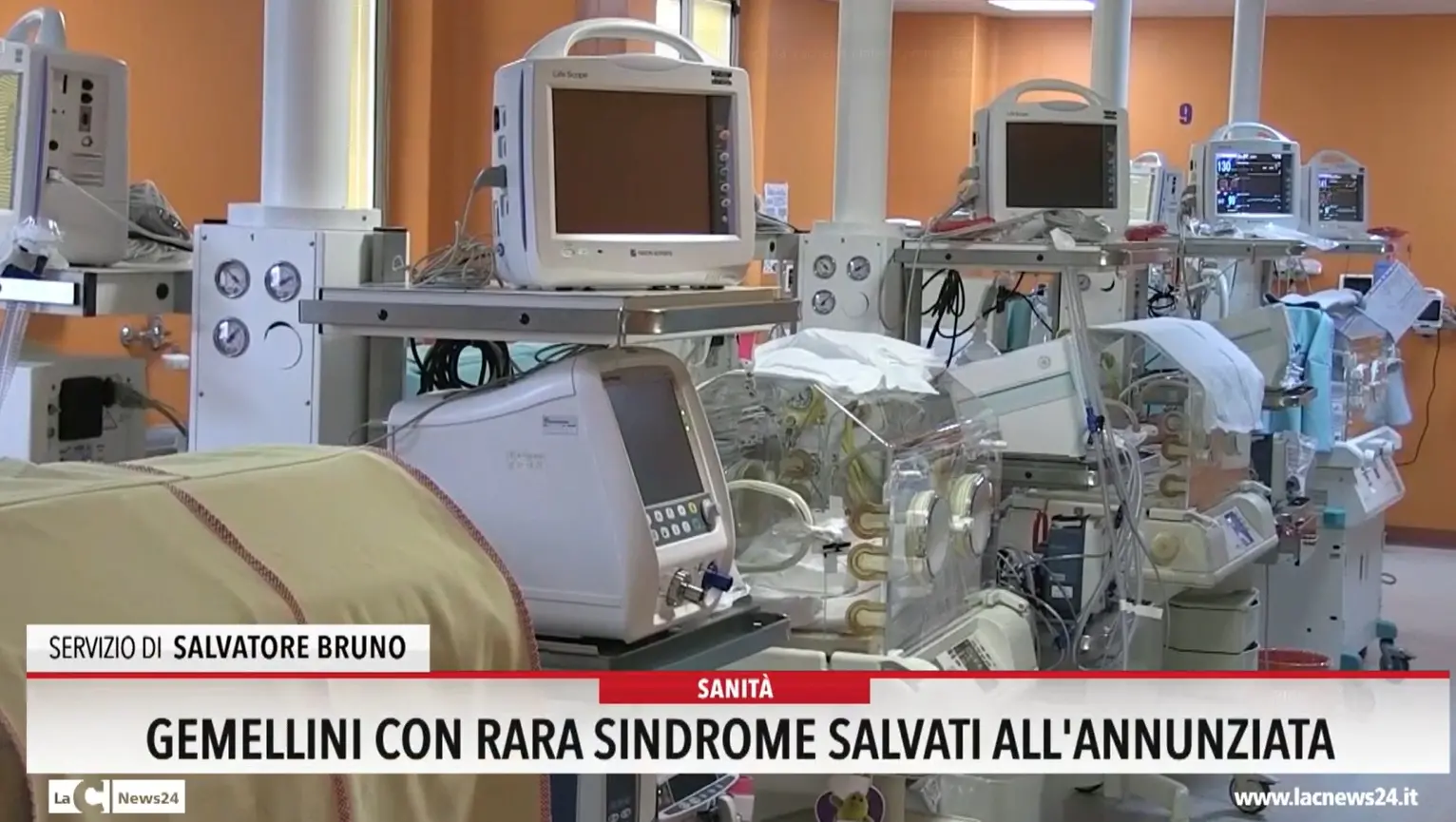 Gemellini con rara sindrome salvati all'Annunziata