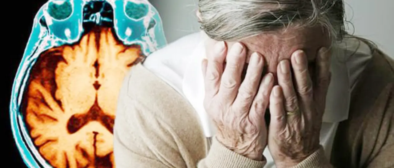 Alzheimer, svolta storica con la nuova terapia a Catanzaro: la\u00A0Dulbecco avvia\u00A0il trattamento con anticorpi\u00A0monoclonali\n