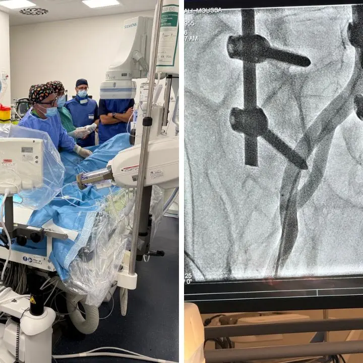 Lamezia Terme, operativa la sala di cardiologia interventistica: eseguite le prime procedure\n