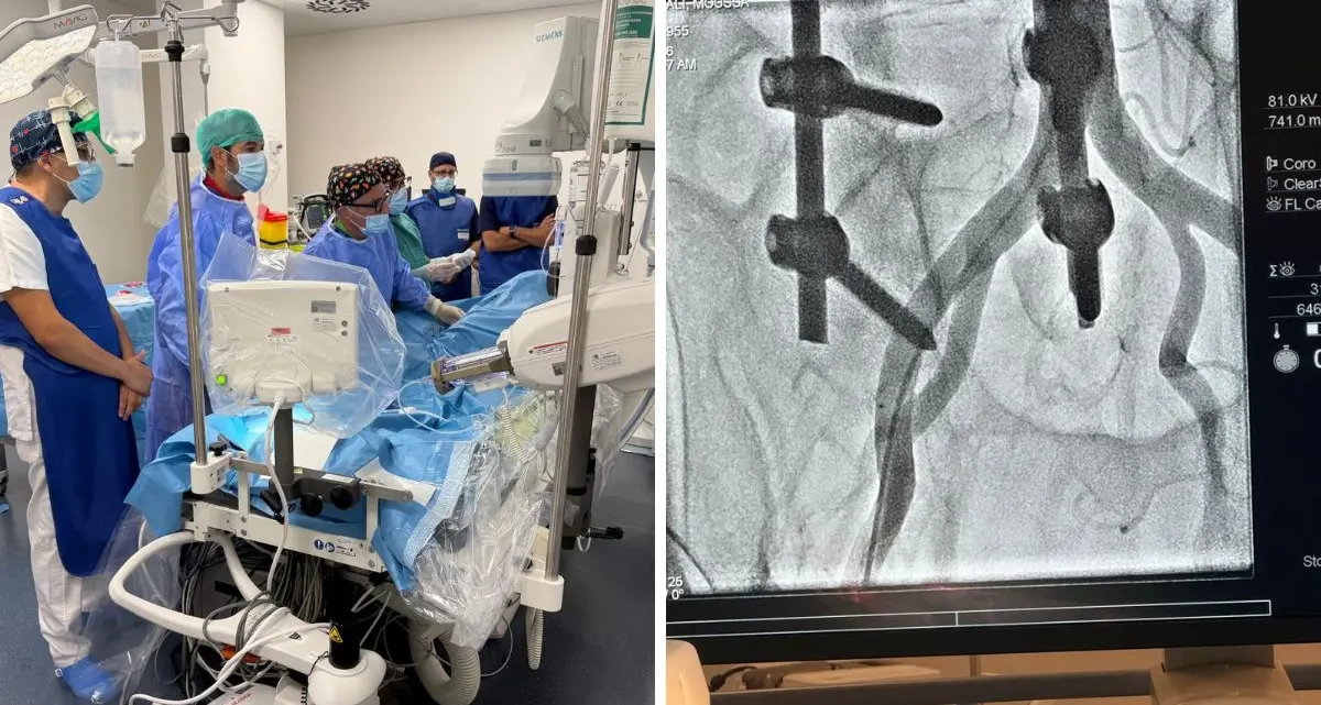 Lamezia Terme, operativa la sala di cardiologia interventistica: eseguite le prime procedure\n