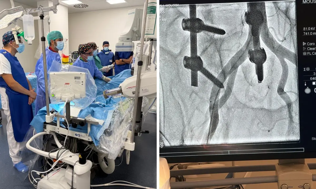 Lamezia Terme, operativa la sala di cardiologia interventistica: eseguite le prime procedure\n