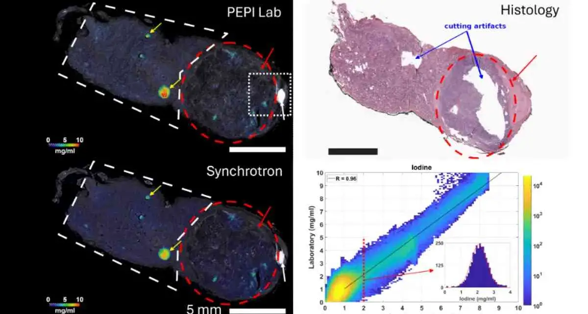 Un nuovo modo di studiare la tiroide grazie all’istologia virtuale: la ricerca Unical con l’Università di Trieste\n