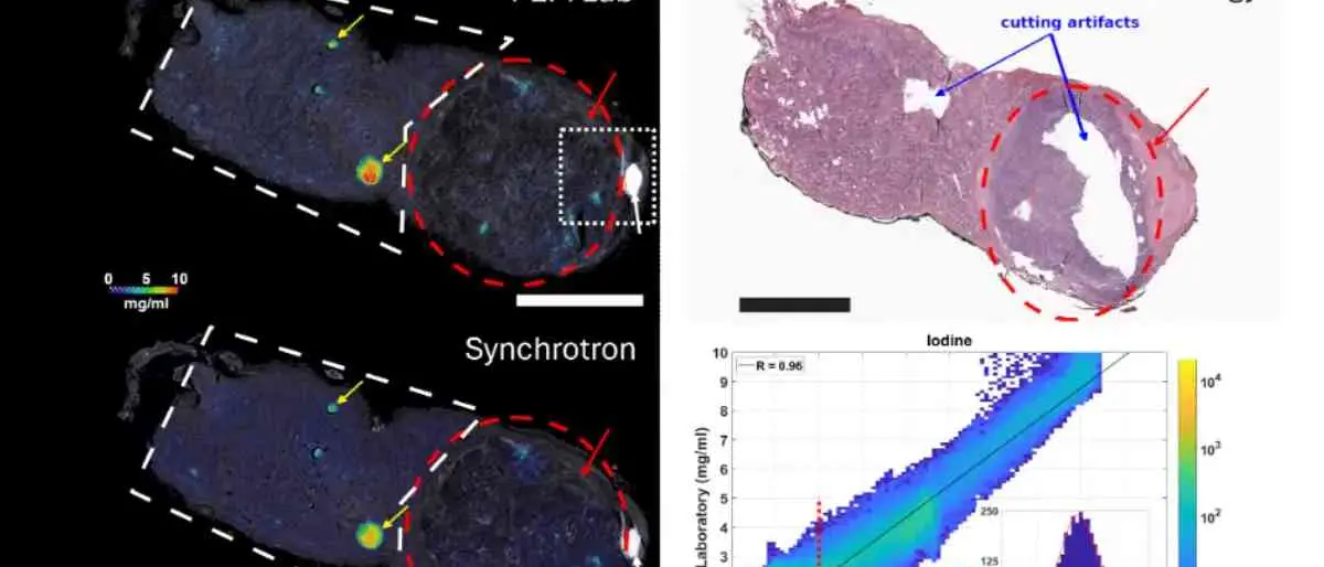 Un nuovo modo di studiare la tiroide grazie all’istologia virtuale: la ricerca Unical con l’Università di Trieste\n
