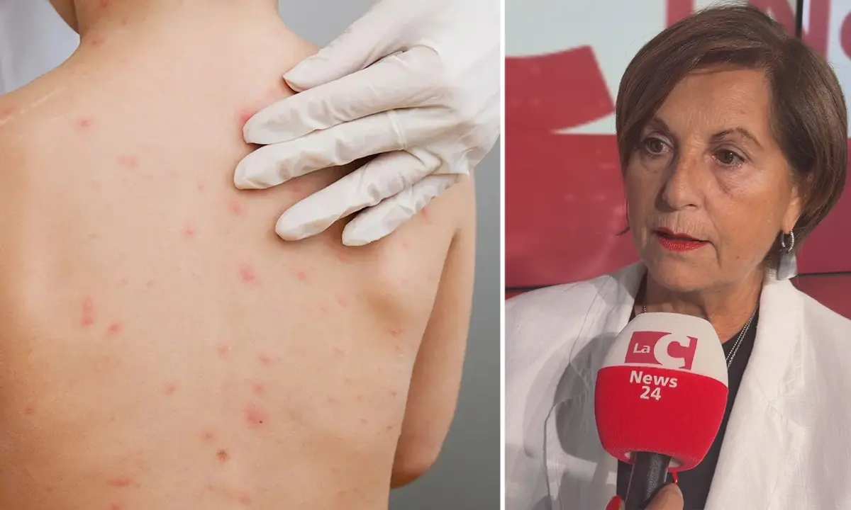 Morbillo, l'allarme della pediatra Galasso: «Non abbassiamo la guardia, vaccino\u00A0l'unica vera arma»\n