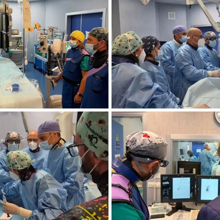 Fibromi uterini, all’Annunziata di Cosenza eseguito il primo intervento di embolizzazione Ufe\n