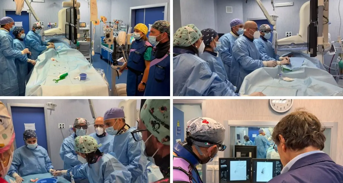 Fibromi uterini, all’Annunziata di Cosenza eseguito il primo intervento di embolizzazione Ufe\n