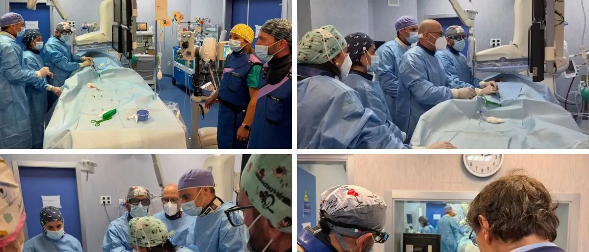 Fibromi uterini, all’Annunziata di Cosenza eseguito il primo intervento di embolizzazione Ufe\n